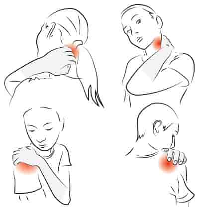 Neck and Arm Pain